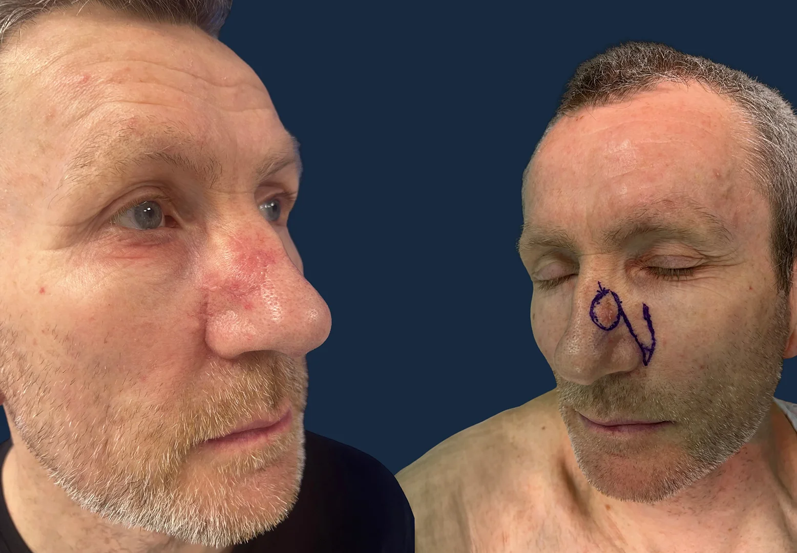 04_Beforeandafter+Dr_Ammar_Allouni