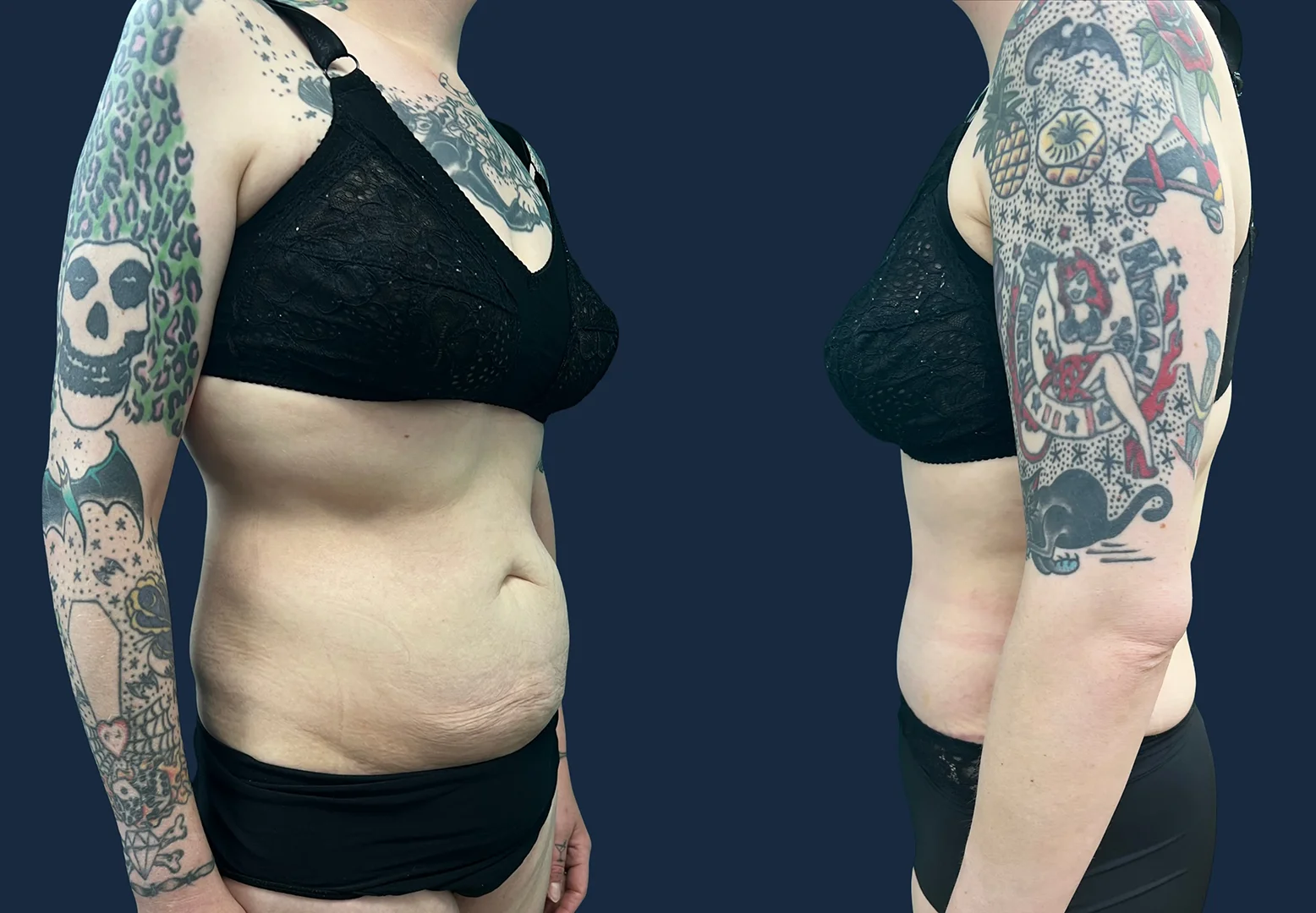 05_Beforeandafter+Dr_Ammar_Allouni