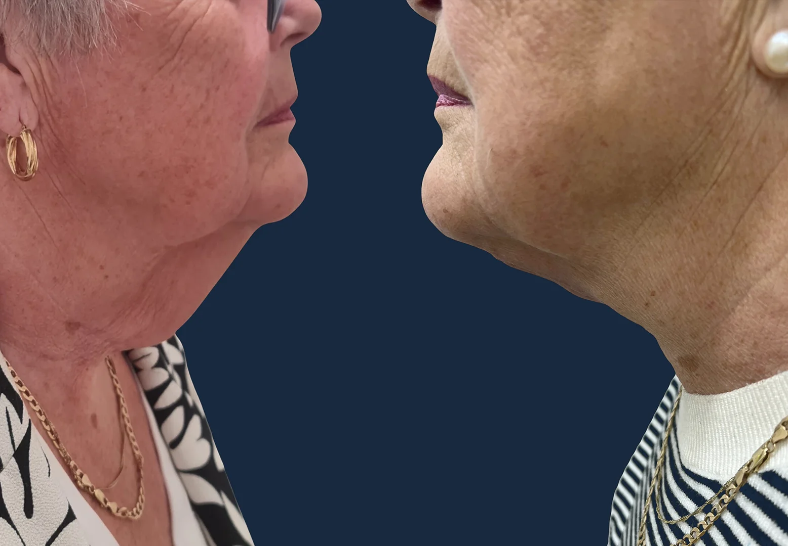 09_Beforeandafter+Dr_Ammar_Allouni